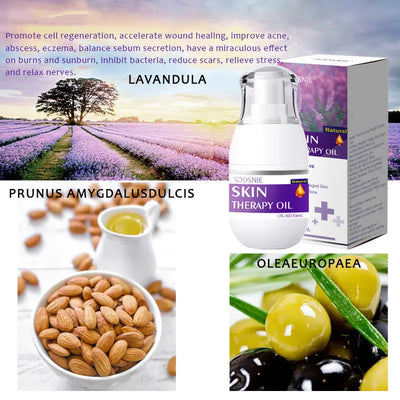 Cilt Bakım Yağı Delinme Selülit Çatlak İzi Giderici Vücut Bakımı 30ml Özer&Hermin