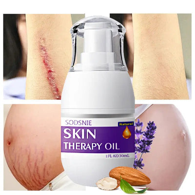 Cilt Bakım Yağı Delinme Selülit Çatlak İzi Giderici Vücut Bakımı 30ml Özer&Hermin